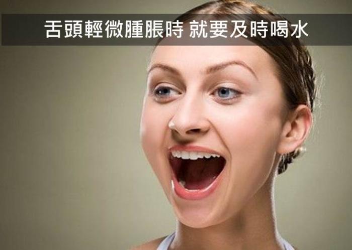 注意！身體缺水 15 個信號，再不喝水就要生病了。