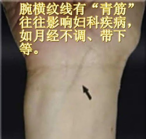 青筋告訴你所不知道的祕密！讓你看清楚身體哪裡出問題。