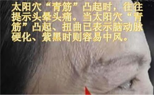 青筋告訴你所不知道的祕密！讓你看清楚身體哪裡出問題。