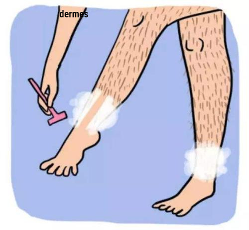 レーザーパルスの時間は髪の自己調節に依存します