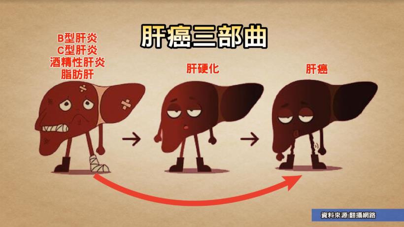 顏清標「換肝」救命！ 小心… 身體發出６個警訊告訴你：肝不好了！ 