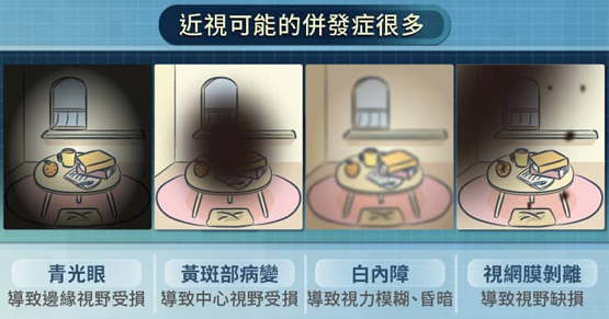 眼睛矯正商機龐大，這家公司EPS一年超過十元。