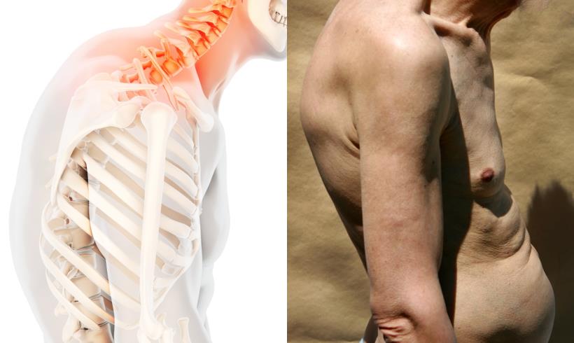 台灣最紅治療師警告：別再忽視 腰痠背痛的警訊…這 5種不良姿勢，讓你 姿勢走鐘、人生也走鐘！