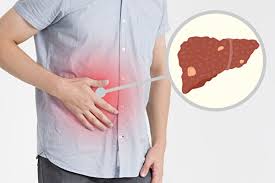 乙肝可以治癒嗎？一文告訴你答案！