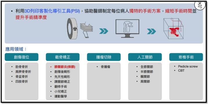 【產業戰隊】膝蓋卡卡，新技術竄起，這檔即將轉上市