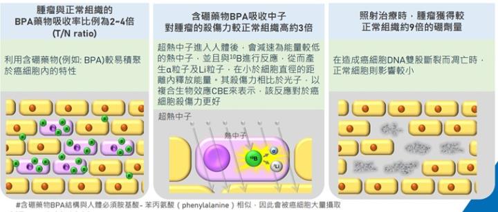 【產業戰隊】台灣唯一癌症高階醫療設備開發大廠