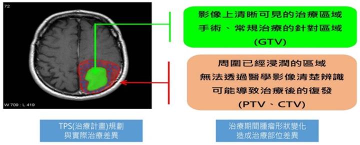 【產業戰隊】台灣唯一癌症高階醫療設備開發大廠