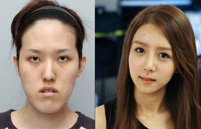 震驚世界的韓國整容技術，妖怪也能整成神仙