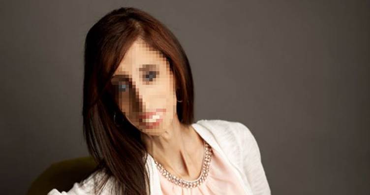 被稱為世界上最醜的女人，麗滋用「這種方式」做出反擊！如今的她，勇敢、快樂而且無與倫比的美麗！好萊塢