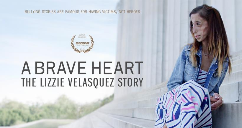 被稱為世界上最醜的女人，麗滋用「這種方式」做出反擊！如今的她，勇敢、快樂而且無與倫比的美麗！好萊塢