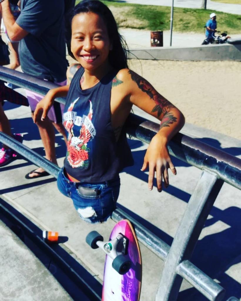 肯亞被棄養、沒有下半身、是個孤兒，她拿出「這個」，竟成為大品牌的模特紅人，下一步還準備進軍奧運！